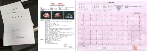 該院體檢中心的體檢報告示例